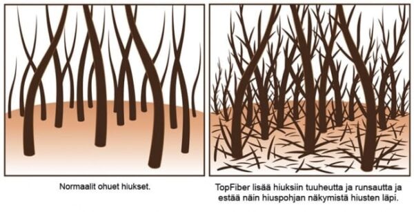 topfiber-hiustuuhenne-toimii-544537c5_orig topfiber-hiustuuhenne-toimii-544537c5_orig